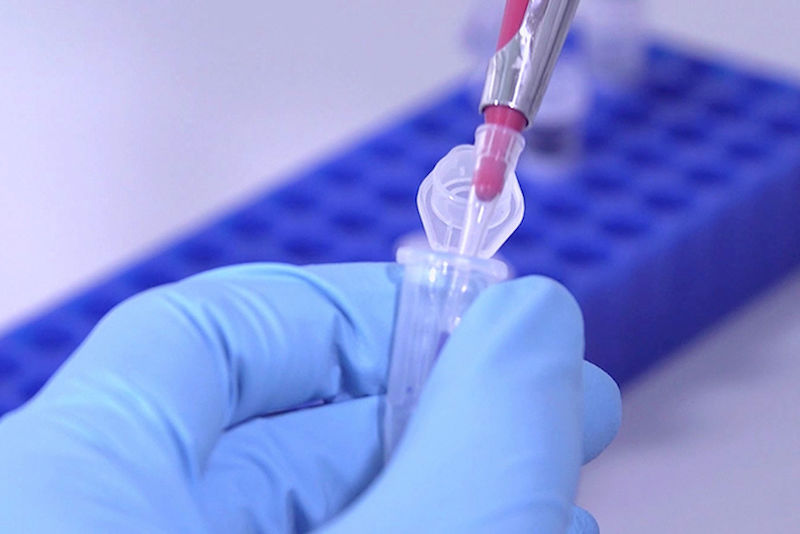 Blutanalyse im Labor